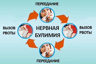 Лечение булимии в Янауле